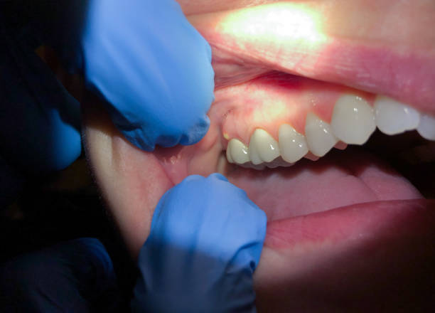 Best Pediatric Emergency Dentist in Morganton, NC
