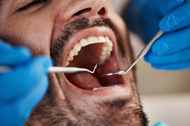 Best Emergency Treatment for Dental Infections or Abscesses in Morganton, NC